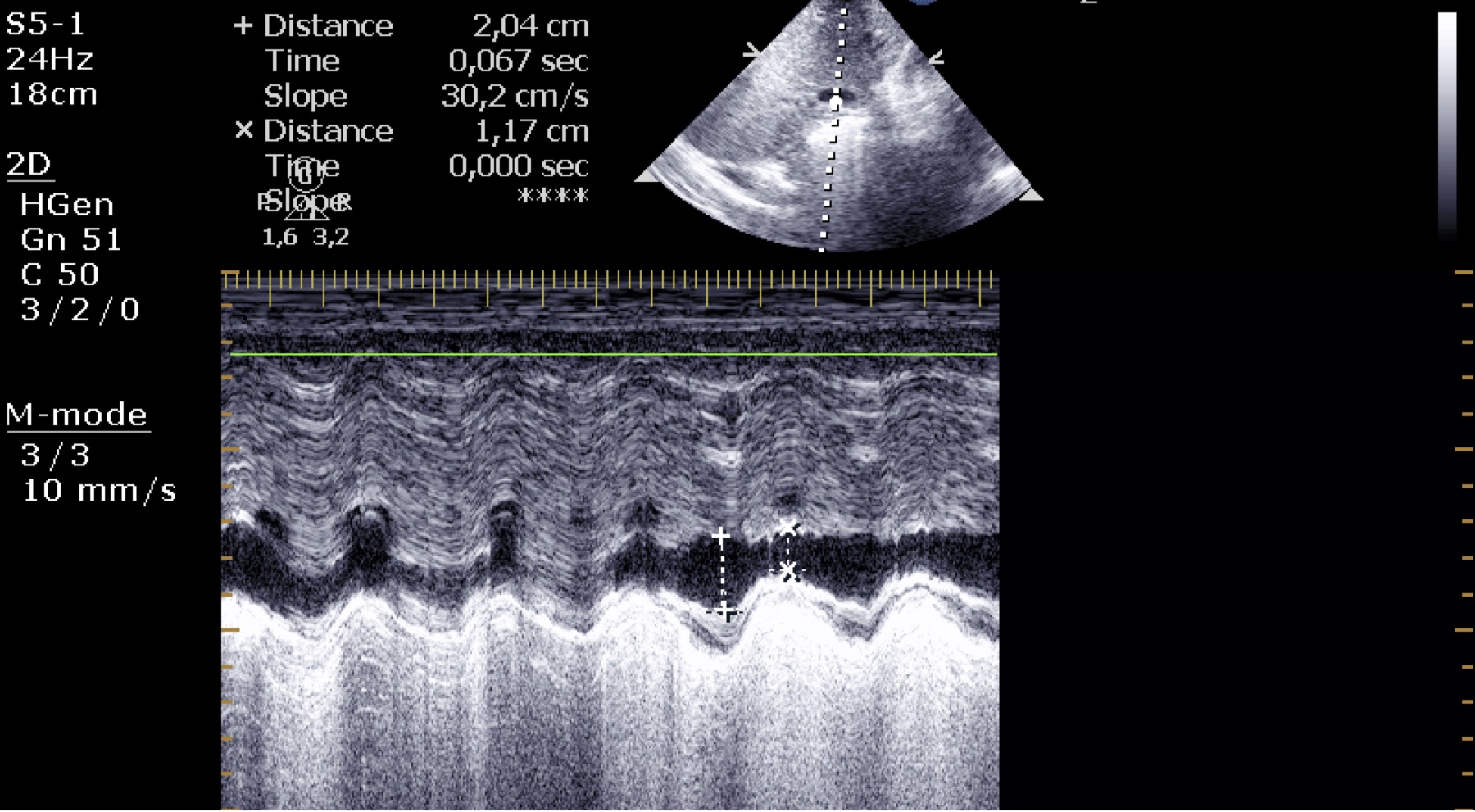 Fig6 IVCCI