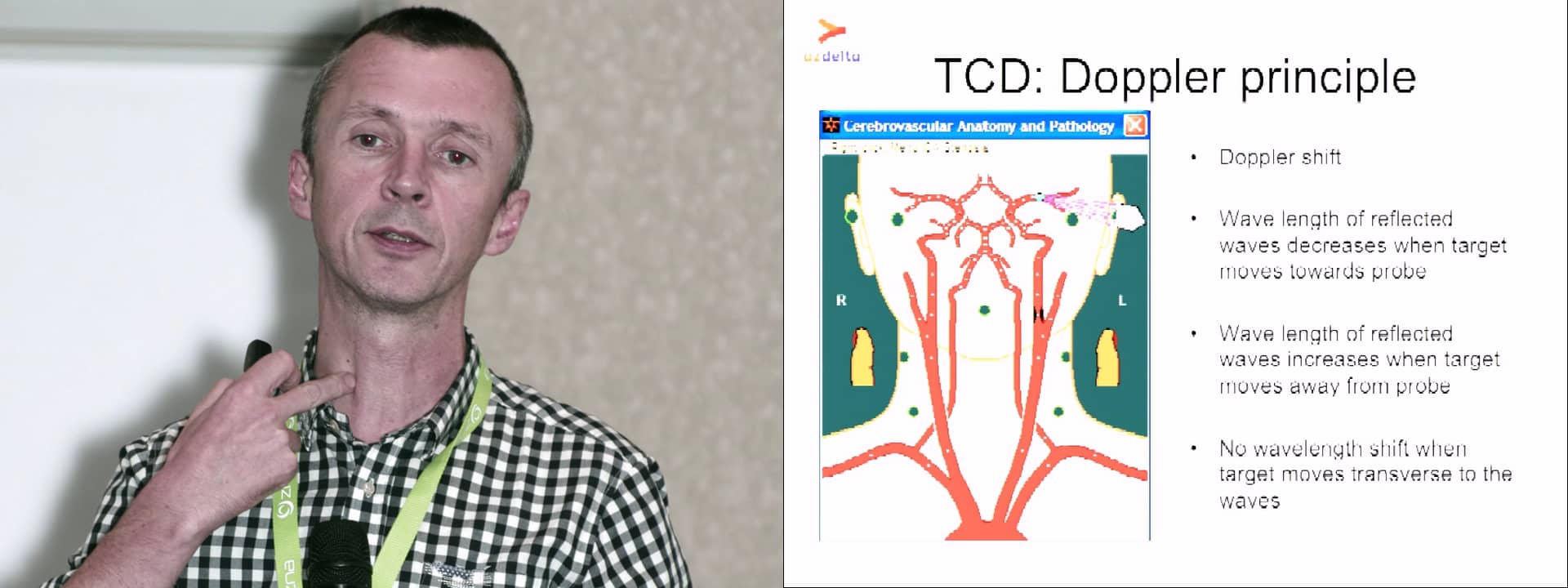 Transcranial doppler (TCD) - vascular access