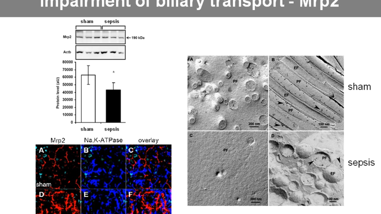 Dry lungs are happy, but a dry liver is deadly: how can dye-dilution help us? - Michael Bauer - IFAD 2011